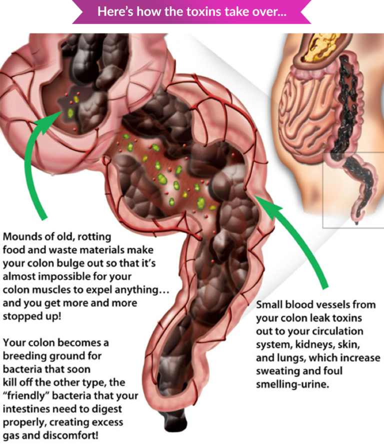 constipation-bowel-movement-functional-health-network-functional