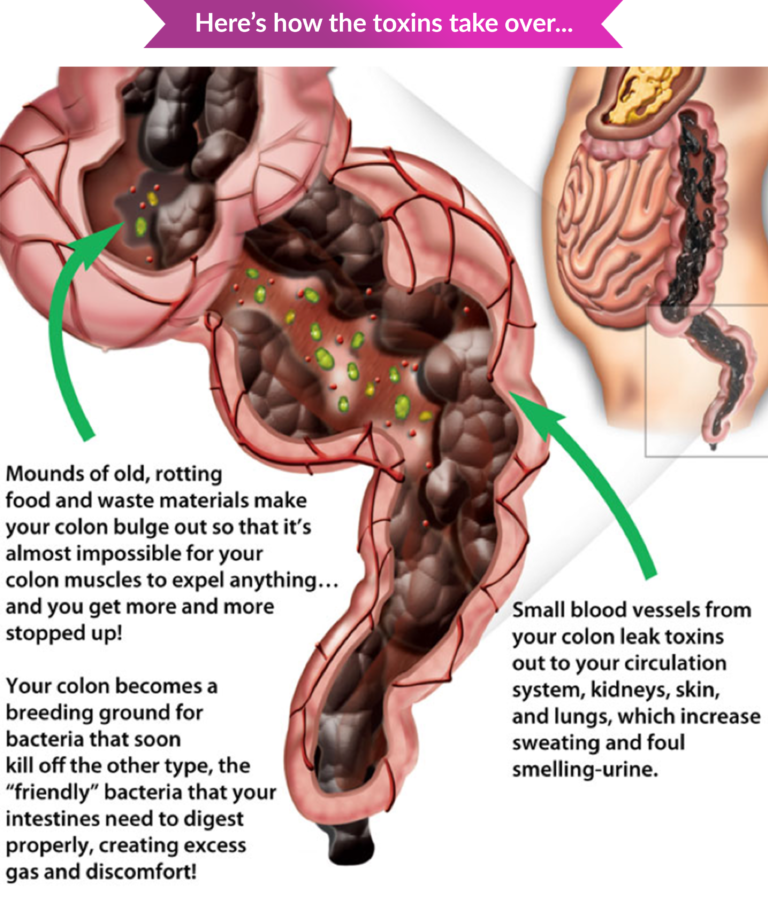 Constipation Bowel Movement Functional Health Network Functional 